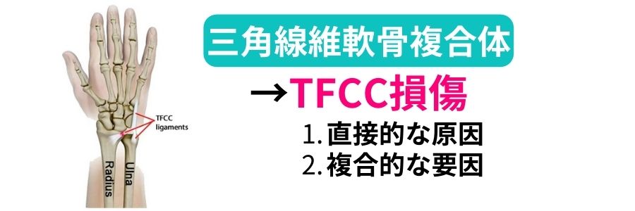 TFCC 損傷